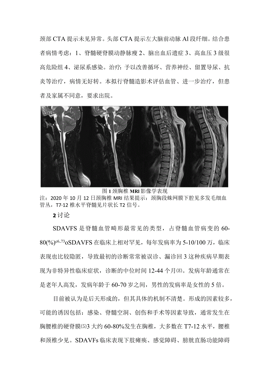 脊髓硬脊膜动静脉瘘1例报道并文献复习.docx_第3页