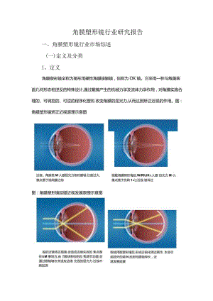 角膜塑形镜行业研究报告.docx