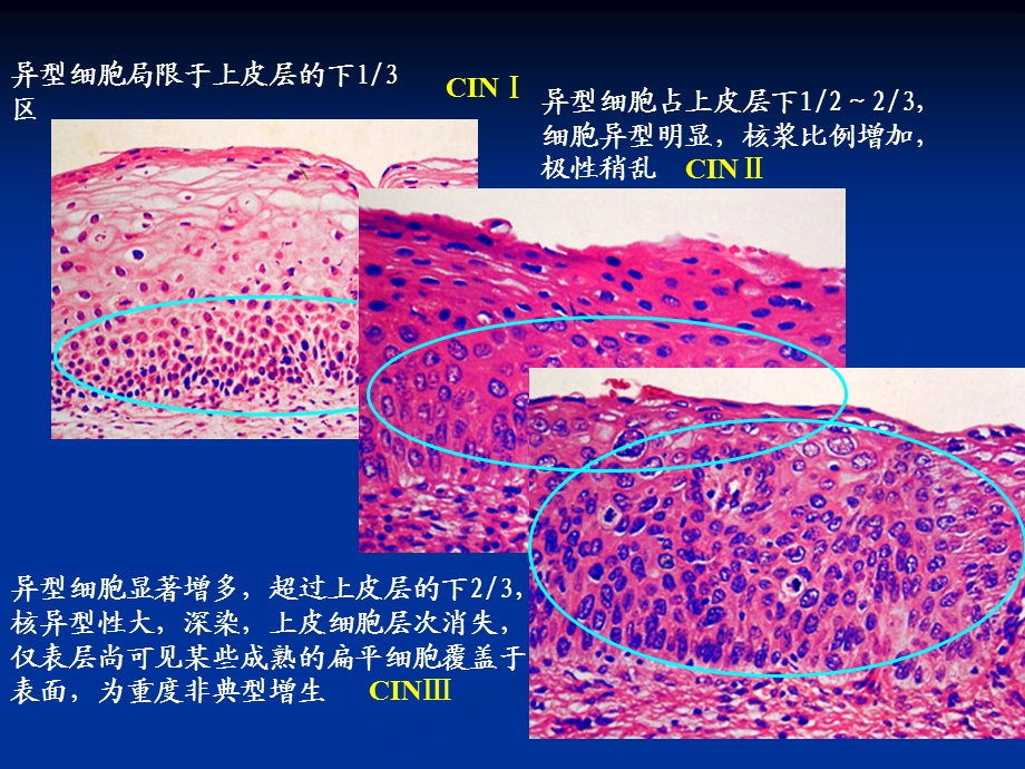 生殖系统疾病ppt演示文稿.ppt_第3页