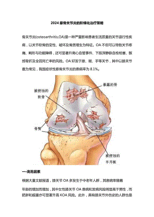 2024膝骨关节炎的阶梯化治疗策略.docx