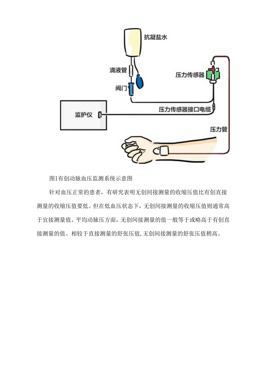 有创动脉血压监测方法及波形解析.docx_第2页