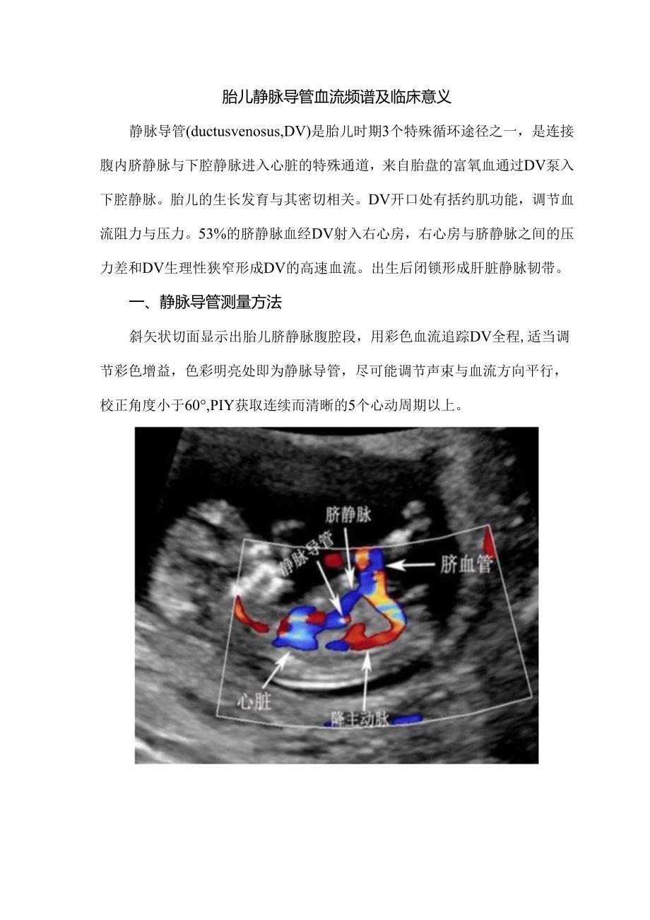 胎儿静脉导管血流频谱及临床意义.docx_第1页