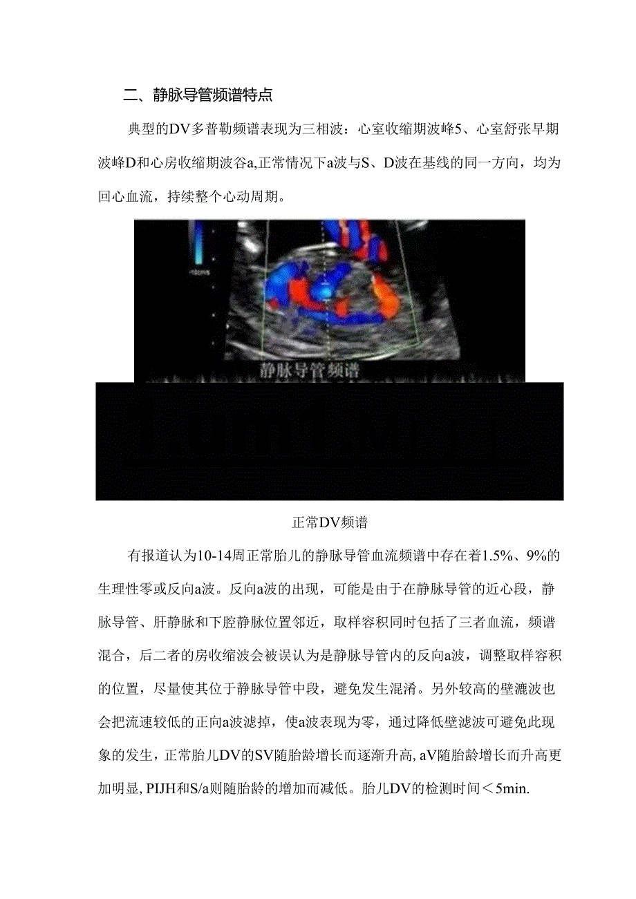 胎儿静脉导管血流频谱及临床意义.docx_第3页