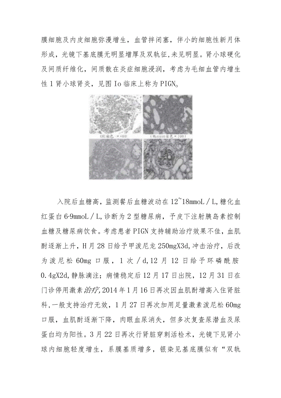 烧伤科医师晋升副主任医师病例分析专题报告（特重度烧伤致感染后肾小球肾炎）.docx_第3页