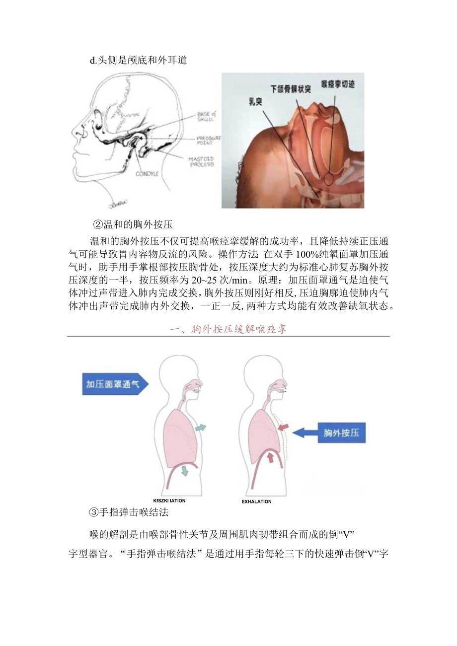 临床全麻苏醒期患者发生喉痉挛病理分享、反思护理及经验分享.docx_第3页