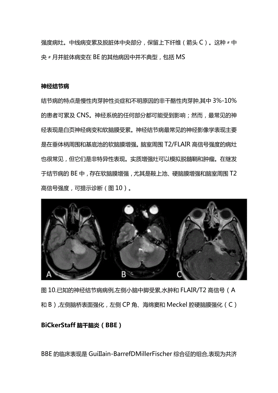 2024非感染性脑干脑炎神经影像学表现（第二部分）.docx_第3页