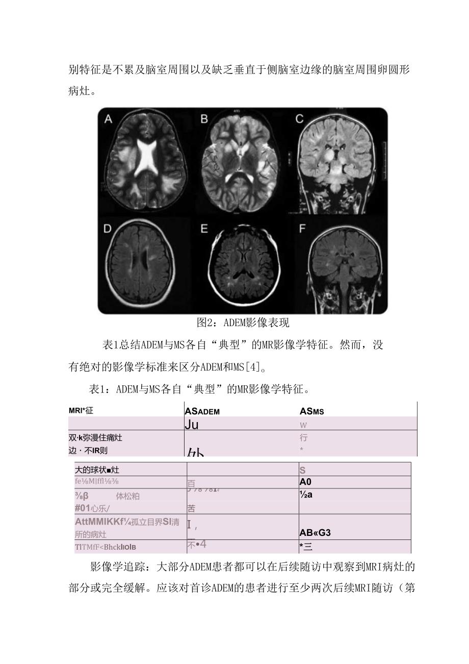 临床多相型播散性脑脊髓炎分类、临床诊断标准、临床表现、影像学特征、鉴别诊断、治疗及预后.docx_第3页