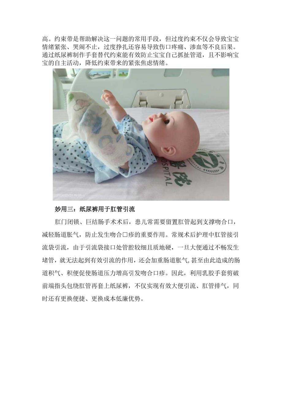 纸尿裤在儿科护理领域使用要点.docx_第2页