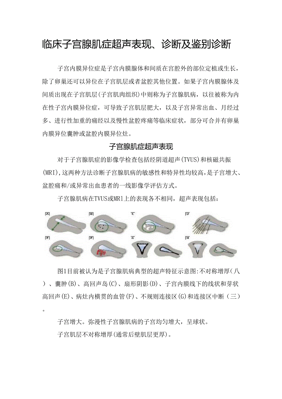 临床子宫腺肌症超声表现、诊断及鉴别诊断.docx_第1页