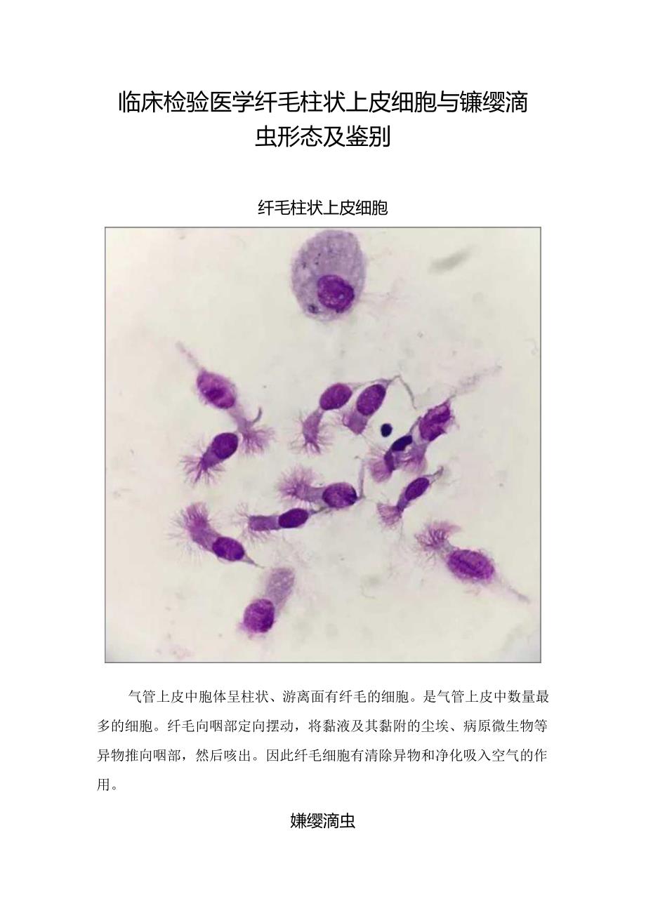 临床检验医学纤毛柱状上皮细胞与蠊缨滴虫形态及鉴别要点.docx_第1页