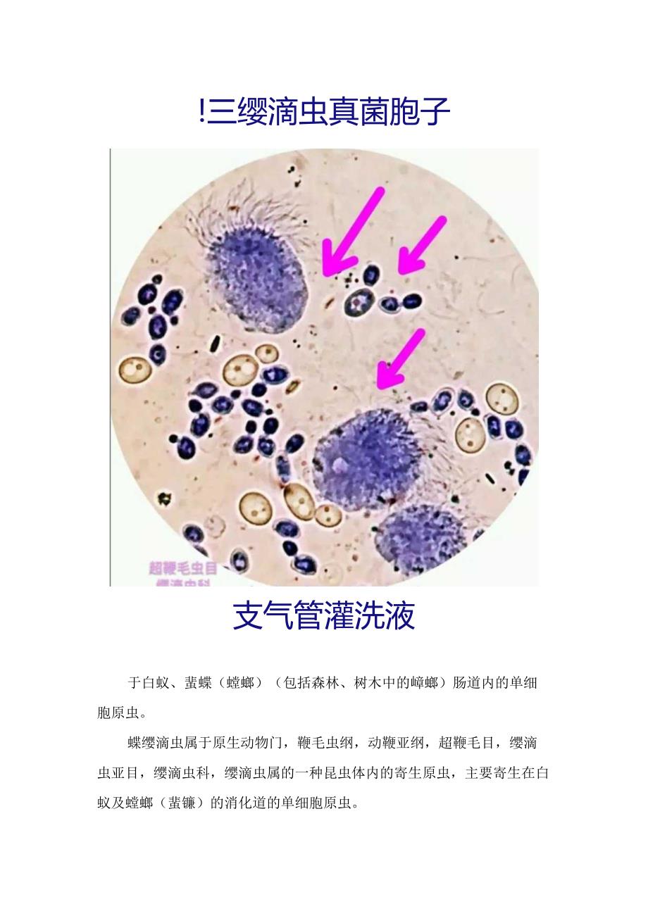 临床检验医学纤毛柱状上皮细胞与蠊缨滴虫形态及鉴别要点.docx_第2页