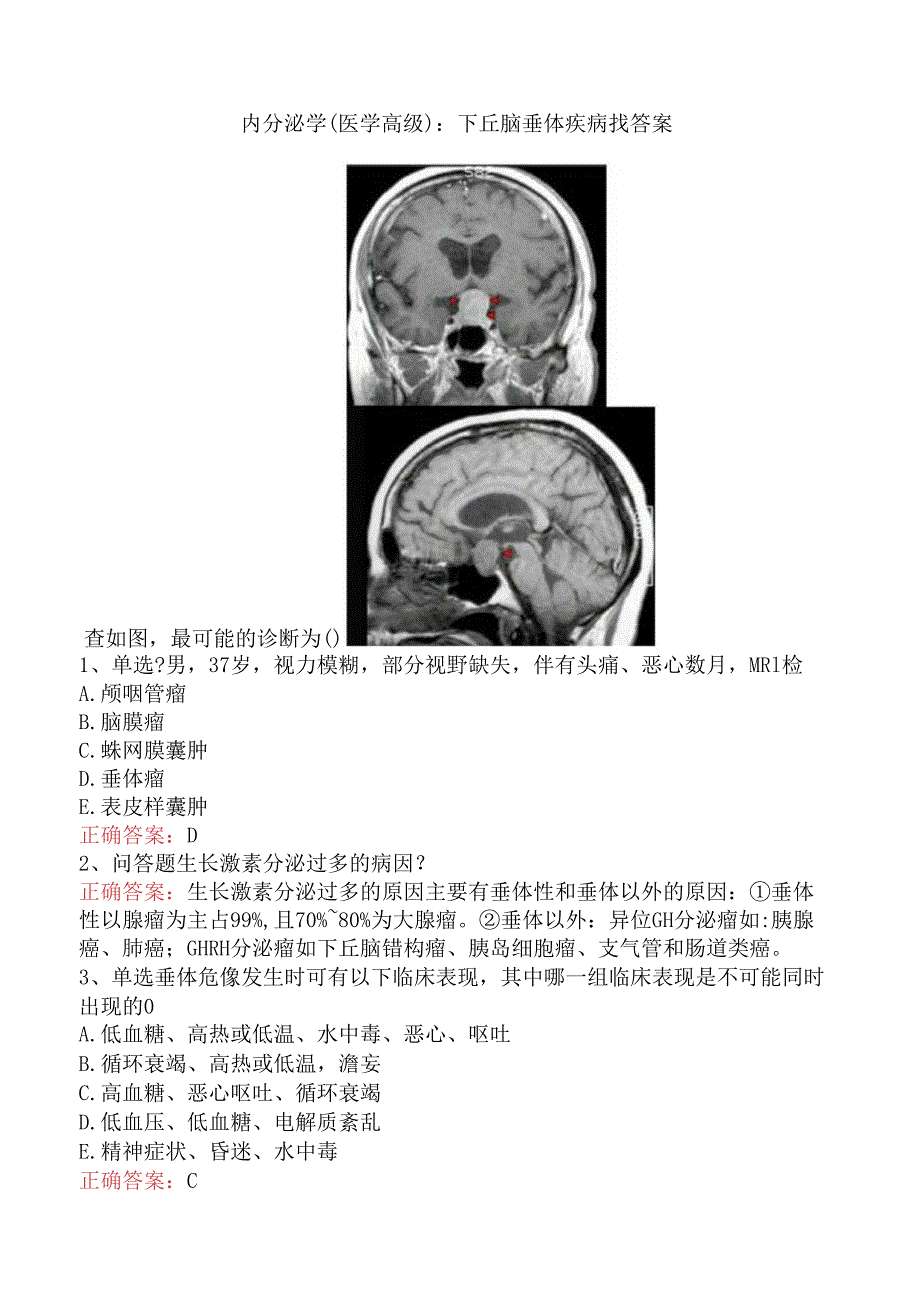 内分泌学(医学高级)：下丘脑垂体疾病找答案.docx_第1页