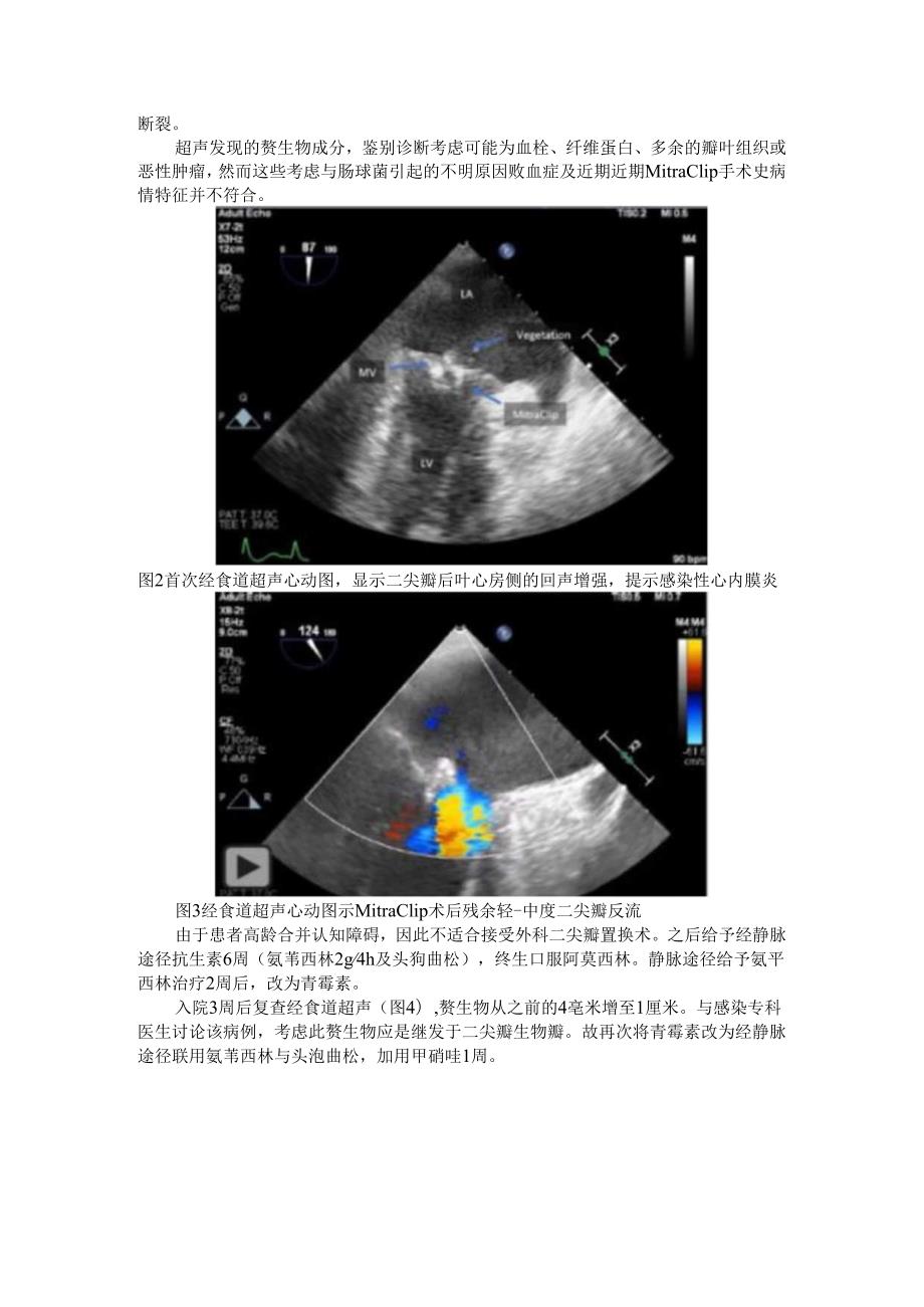 病例 MitraClip相关感染性心内膜炎.docx_第2页