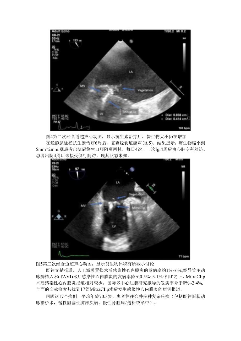 病例 MitraClip相关感染性心内膜炎.docx_第3页