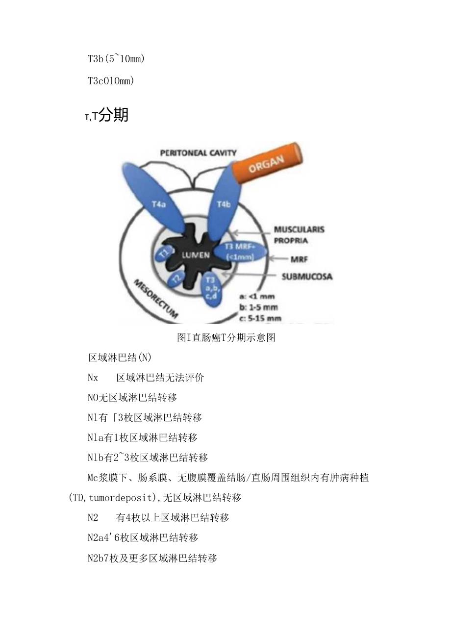 直肠癌TN分期、直肠癌超声分期诊断结构及中上段直肠癌和下段直肠癌及直肠肛管癌分期区别要点.docx_第2页