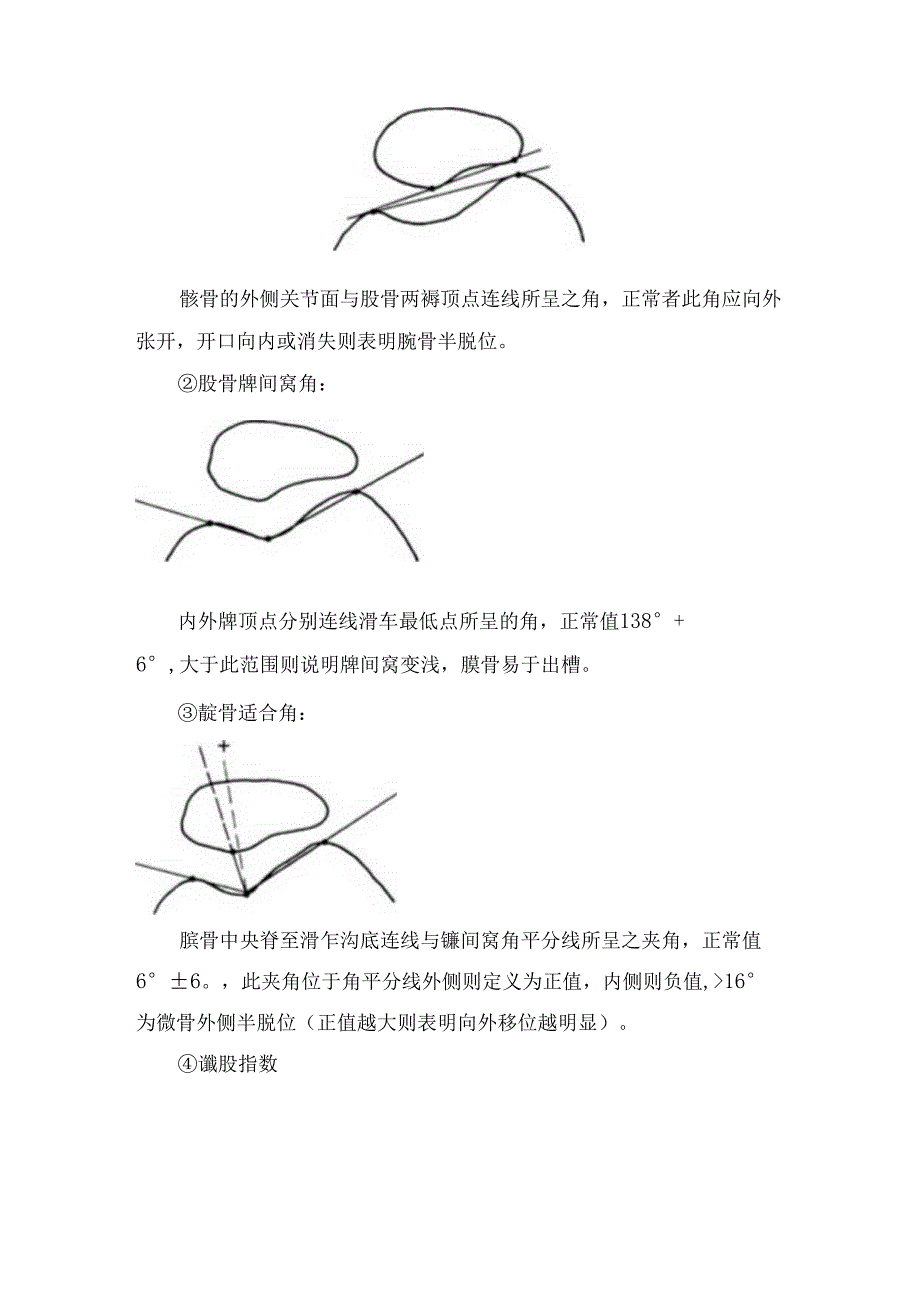 髌骨脱位临床检查、诊断、治疗策略和手术方式.docx_第3页