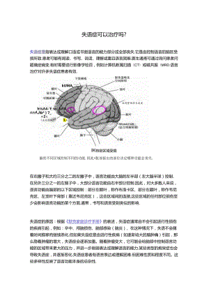 失语症可以治疗吗？.docx