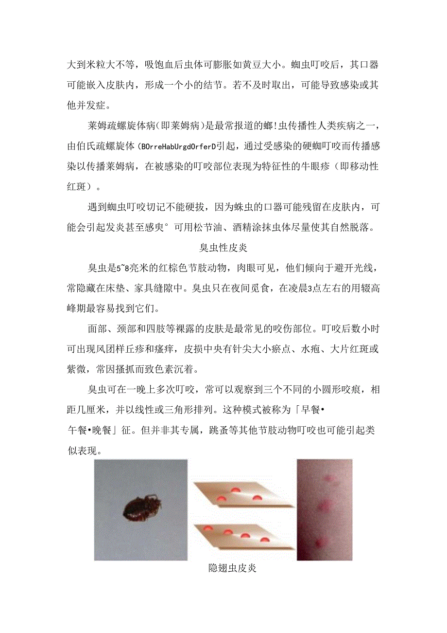 蚊虫叮咬、螨虫性皮炎等各类虫咬皮肤表现及要点总结.docx_第3页