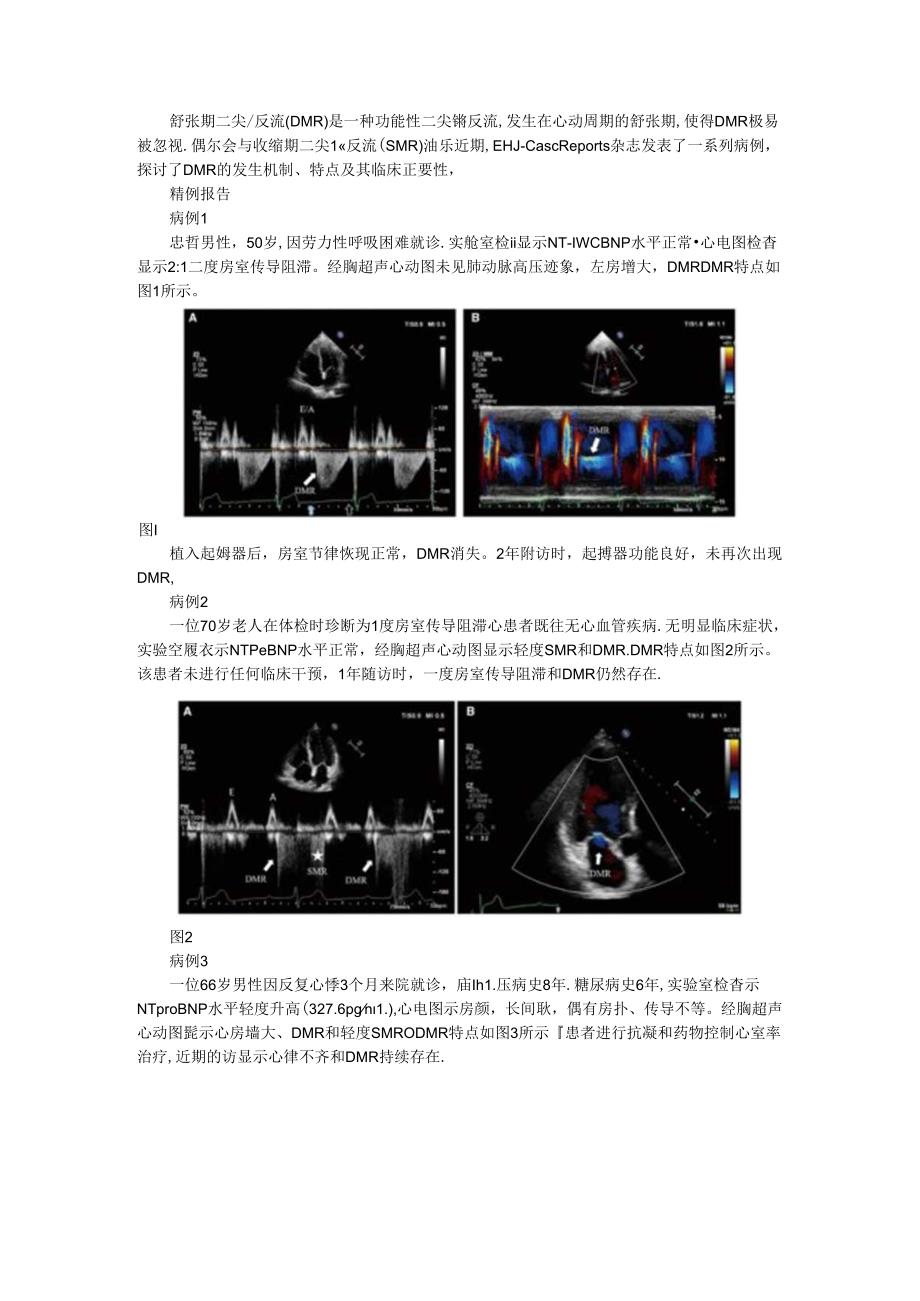 从系列病例探讨舒张期二尖瓣反流的机制及特点.docx_第1页