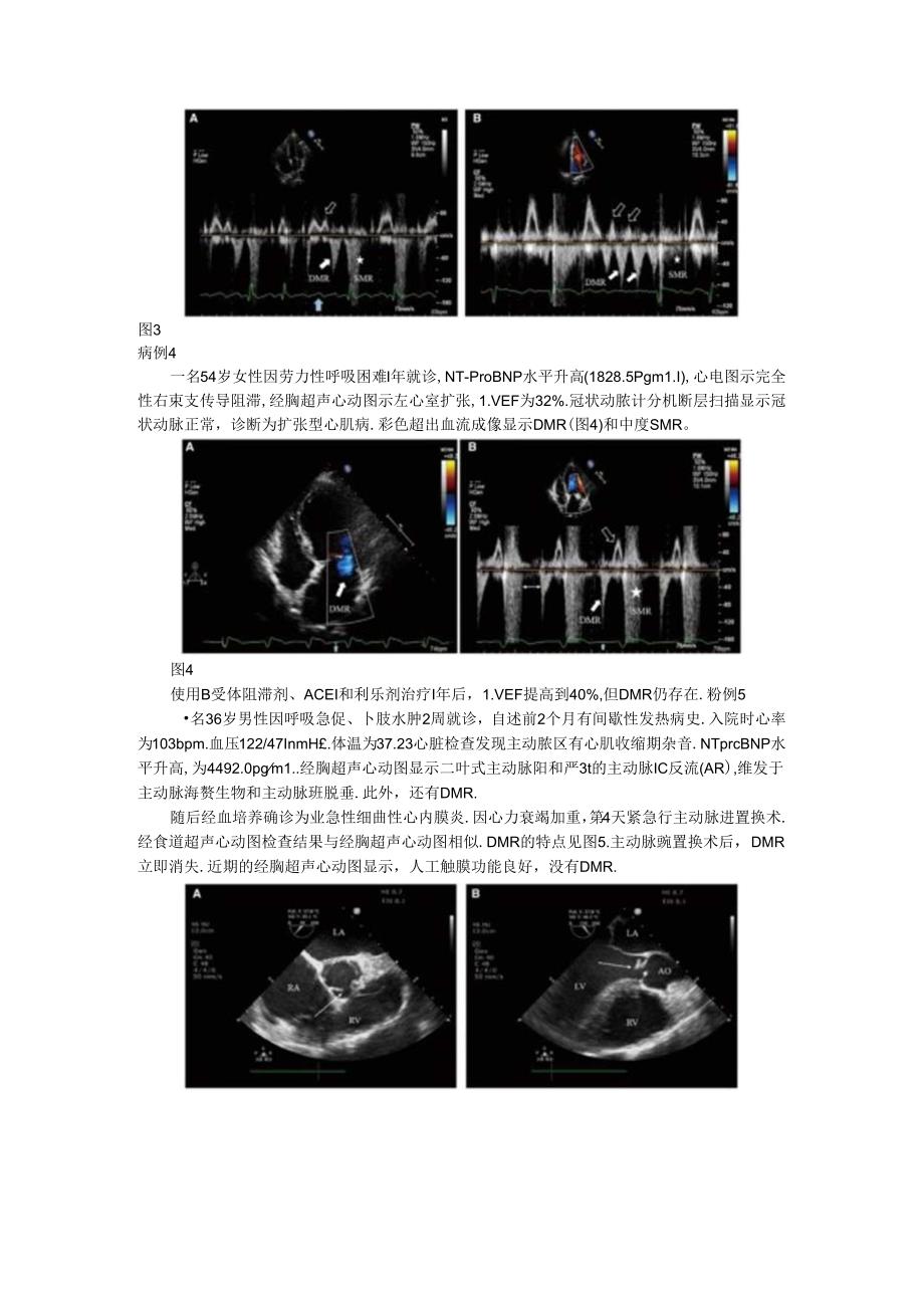 从系列病例探讨舒张期二尖瓣反流的机制及特点.docx_第2页