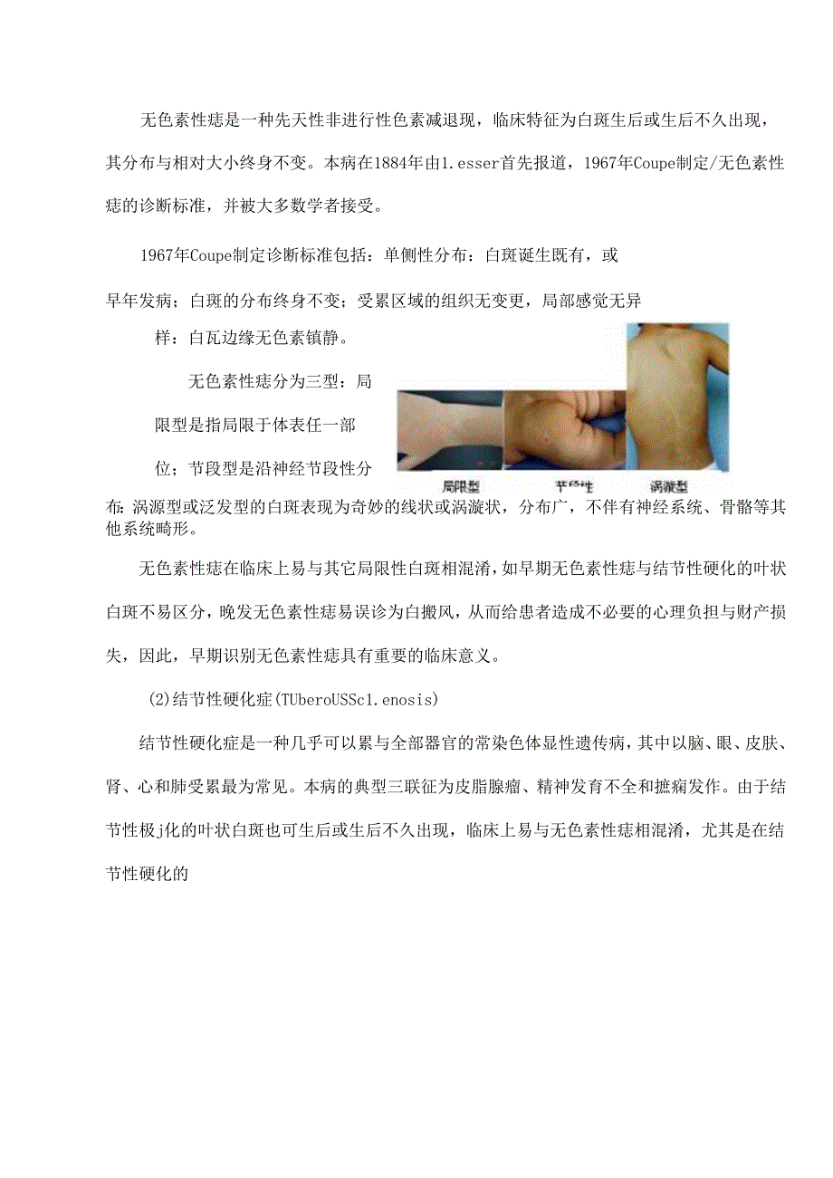 儿童常见色素性皮肤病的诊断与鉴别报告[1].docx_第3页